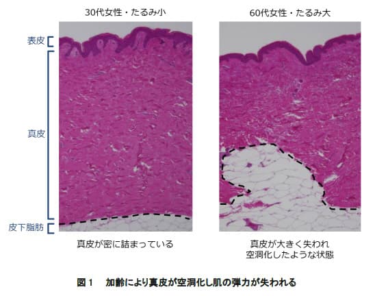 資生堂、肌の「真皮の空洞化」がたるみの原因と発見。改善のカギは脂肪の幹細胞