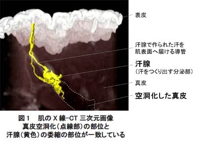 資生堂が発見、顔のたるみの原因は「汗腺の委縮」にあった